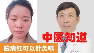 臉癢紅可以針灸嗎【保健養生】生生不息┃濕熱過重┃氣虛┃上焦濕熱