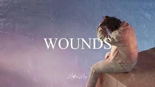 [FREE] Lewis Capaldi x Piano Ballad Type Beat - "Wounds"