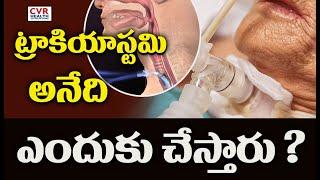 ట్రాకియాస్టమి అనేది ఎందుకు చేస్తారు ?|tracheostomy| CVR Health