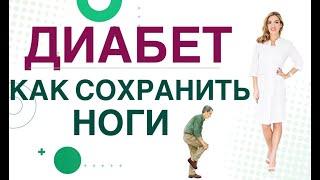  Сахарный диабет. Осложнения. Диабет стопа, как сохранить ноги? Врач эндокринолог Ольга Павлова.