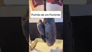 Veja o que o cigarro faz com o Pulmão #anatomia #pulmão #medicina
