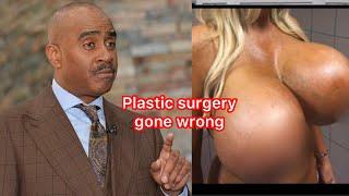 Pastor Gino Jennings plastic surgery gone wrong