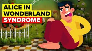 This Syndrome Will Make You Question What Is Real (Alice In Wonderland Syndrome)