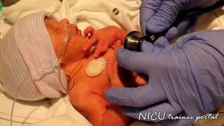 Physical Exam- 31 weeks gestation preterm infant