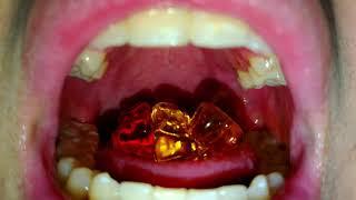 Eating gummy bears | VORE UVULA TONGUE MOUTH #vore #uvula