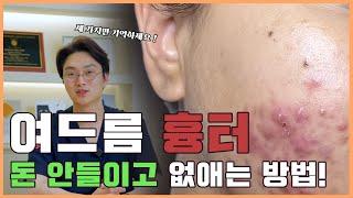 피부과 의사가 알려주는 여드름흉터없애는 방법|여드름 흉터가 생기는 이유와 집에서 할 수있는 방법 알려드립니다.