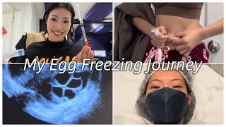 MY EGG FREEZING JOURNEY ‍️ | Lucia Liu - (prep/cost/schedule/ultrasounds )