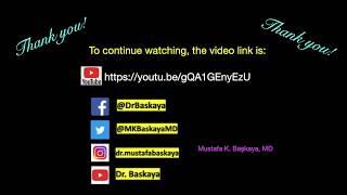 Microsurgery of Arteriovenous Malformations