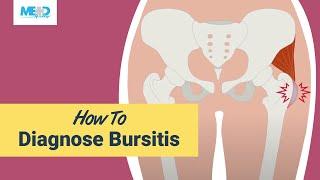 How to diagnose bursitis