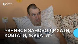 "Вчився дихати, ковтати, жувати": як боєць реабілітується у Луцьку