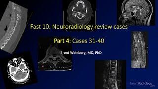 Fast 10: Neuroradiology high speed case review part 4 - Cases 31-40