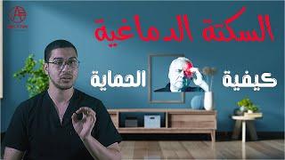 ازاي احمي نفسي من السكتة الدماغية | السكتة الدماغية | أعراض السكتة الدماغية - Stroke