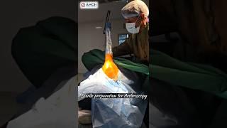 "This Keyhole Surgery Ends Years of Shoulder Pain Instantly!” #orthodoctor #jointsurgeon #shorts