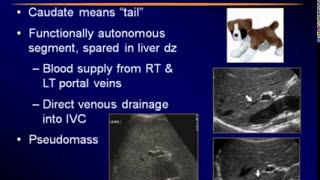 Sonography of the Liver