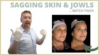 How Loose and Sagging Jowls can be Treated at Quinn Clinics Bristol | Dr. John Quinn Explains!