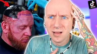 Scratcher Tattoo Ends With TERRIBLE Infections | New Tattoo TikTok Fails 25 | Roly