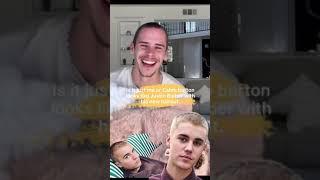 Caleb burton looks more like Justin Bieber Now!