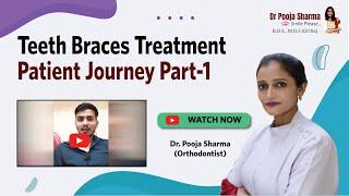 Teeth Braces Treatment Experience | Orthodontist in Agra for Smile Makeover - Dr Pooja Sharma Agra