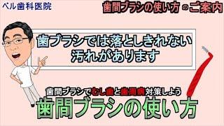 【ベル歯科医院の歯科衛生士が解説】歯間ブラシについて