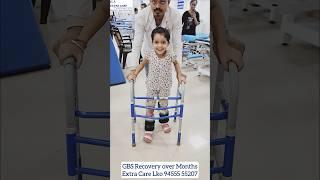 GBS Recovery over Months | Gullian Barre Syndrome Physiotherapy Rehab | Extra Care Lko 9455555207