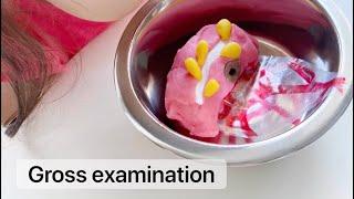 Playdough Surgery  - Part 2: Pathology - Gross Examination