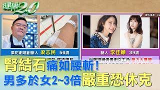 腎結石痛如腰斬！男多於女2~3倍 嚴重恐休克 健康2.0