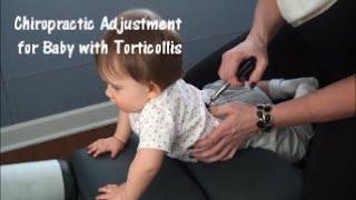 Chiropractic Adjustment for Baby with Torticollis