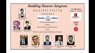 Budding Ilizarov Surgeons – GUJRAT STATE : Tibia Fractures dealt with Ilizarov Fixators