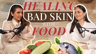 Why Your Skincare Routine Isn’t Working | Gut & Hormone Fixes for Acne | Masoom Minawala Show