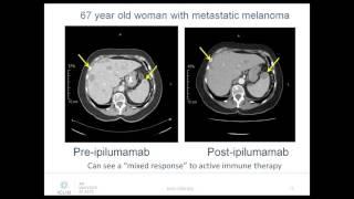 ICLIO Webinar - The Role of the Radiologist in I-O