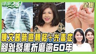 陳文茜肺癌轉移又光毒症 腳趾發黑折磨逾60年！紅斑性狼瘡攻擊心肺腎 女赴瑞安樂死！ 健康2.0 20241214【完整版】陳欣湄 韋汝 蔡昀臻 柳朋馳 洪素卿 彥寬 羅珮琳