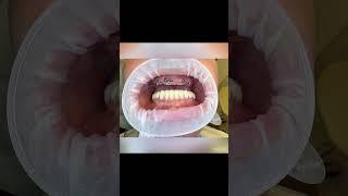Красивые зубы — это реальность?#шортс #москва #music #зубы