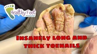 CUTTING INSANELY LONG TOENAILS!