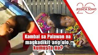 Kambal sa Palawan na magkadikit ang ulo, kumusta na? | Kapuso Mo, Jessica Soho