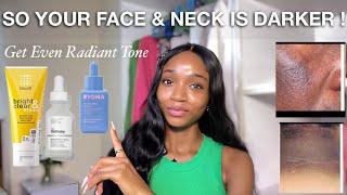 How to Achieve an Even Radiant Face & Neck | 10 Step Treatment to Get Rid of Darker Face and Neck