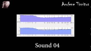 Sound 4 - fast tinnitus relief - sollievo acufene rapido