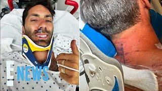 Catfish Host Nev Schulman: “Lucky to be Alive” After Breaking His Neck in Bike Accident | E! News