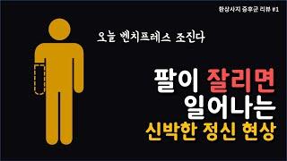 팔이 없는데 팔이 있는 것처럼 느껴져요! (환상사지 증후군 1편)