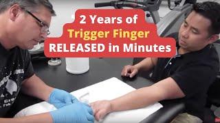 2 Years of * Trigger Finger *  RELEASED in Minutes (REAL RESULTS!!)