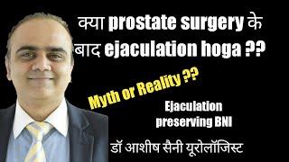 क्या प्रोस्टेट सर्जरी के बाद Ejaculation  होगा ? High UB neck treatment