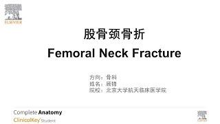 顧鋒 股骨頸骨折 Femoral Neck Fracture |  The PBL Challenge to Expand Global Medical Horizons Silver Award