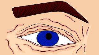 Eyelid Twitching? - How to Stop it in 4 minutes INSTANTLY!