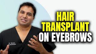 Eyebrow Hair Transplant