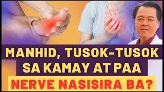 Manhid, Tusok-Tusok sa Kamay at Paa: Nerve Nasisira Ba? - By Doc Willie Ong