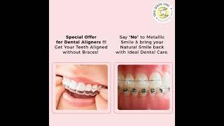 Best Dental Clinic in Indore for Clear Aligner