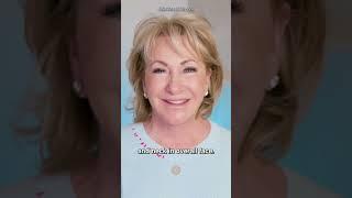 Not All Facelifts are the Same | Dr. Kevin Sadati #plasticsurgery #facelift #cosmeticsurgery