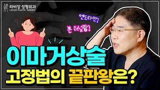 제 가족에겐 OOOO으로 이마거상 해줬습니다. 효과 좋은 이마거상 고정법은?