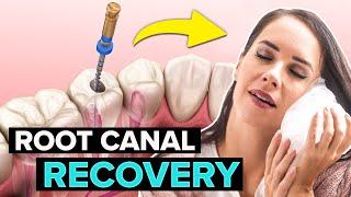 5 Root Canal Recovery Tips To Heal FAST!