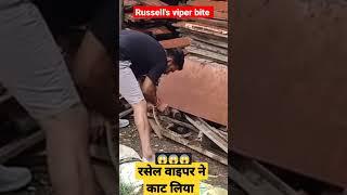 live russell viper snake bite #shorts #youtubeshorts #viralvideo