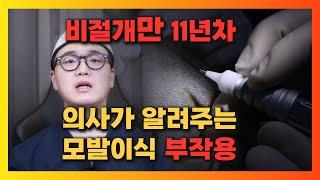 모발이식 단점, 부작용, 실패 사례  공개